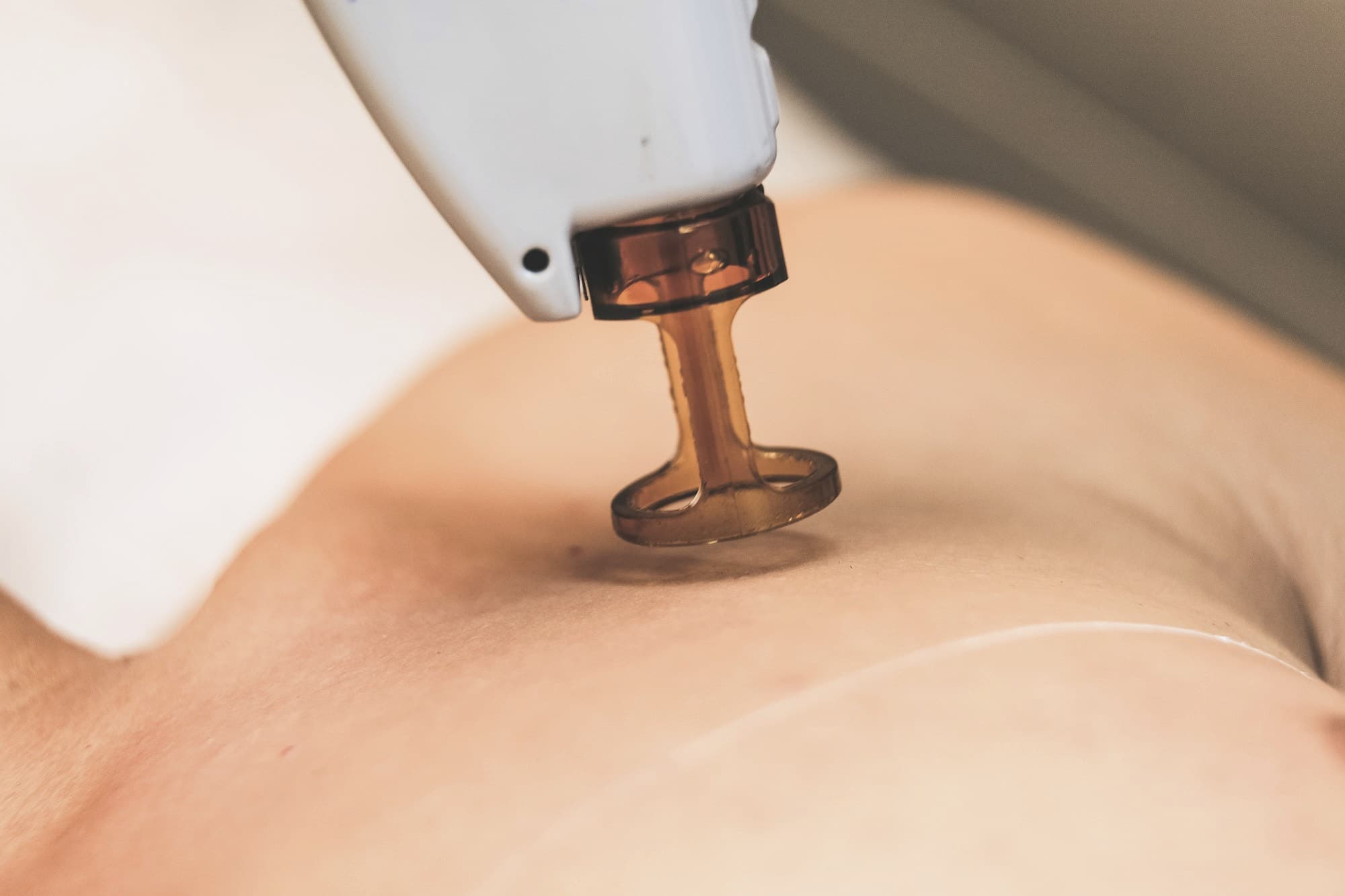 Close-up of a laser handpiece tip on skin